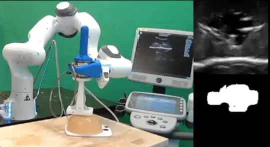 Autonomous Ultrasound Scanning